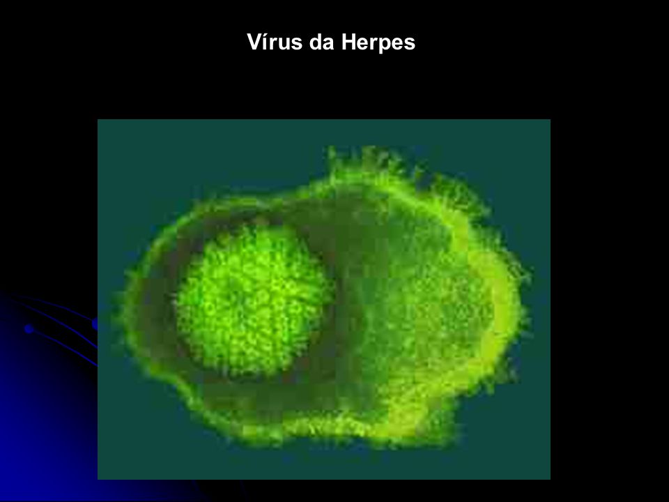 Vírus da Herpes
