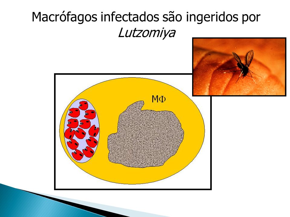 Macrófagos infectados são ingeridos por Lutzomiya