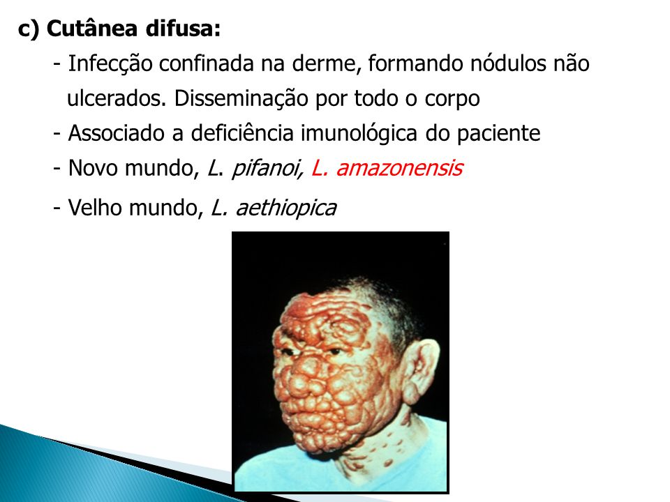 c) Cutânea difusa: - Infecção confinada na derme, formando nódulos não. ulcerados. Disseminação por todo o corpo.