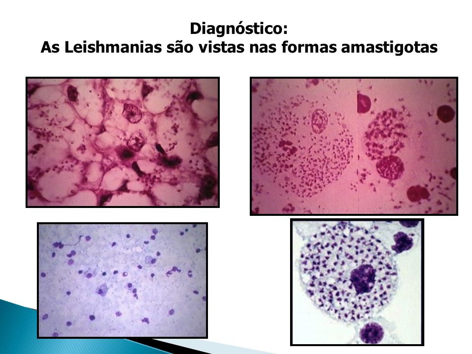 As Leishmanias são vistas nas formas amastigotas