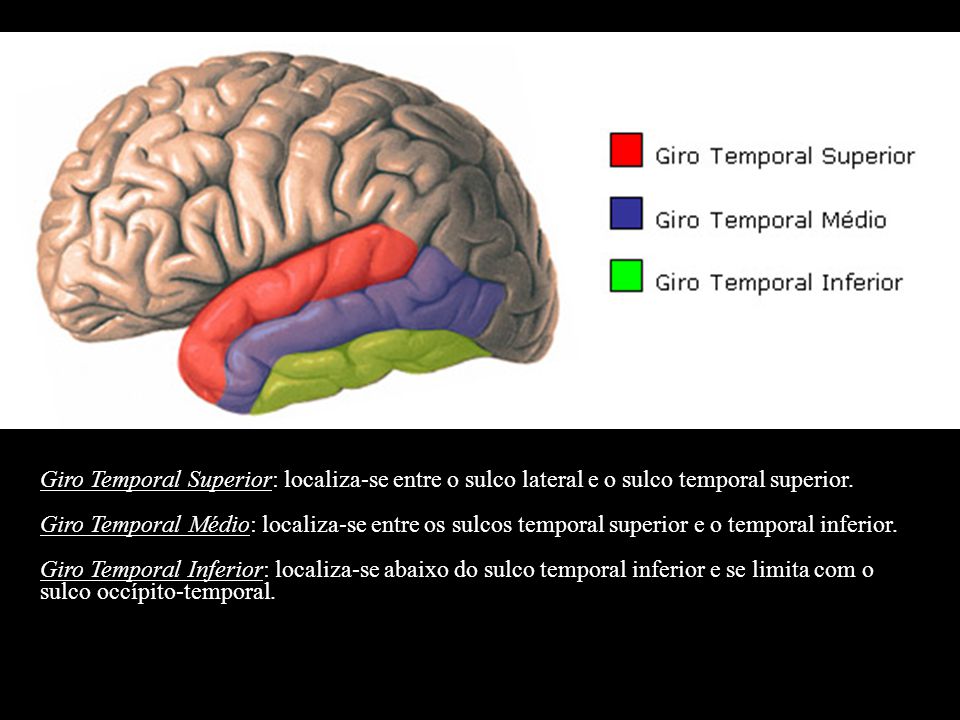 Giro Temporal Superior: localiza-se entre o sulco lateral e o sulco temporal superior.