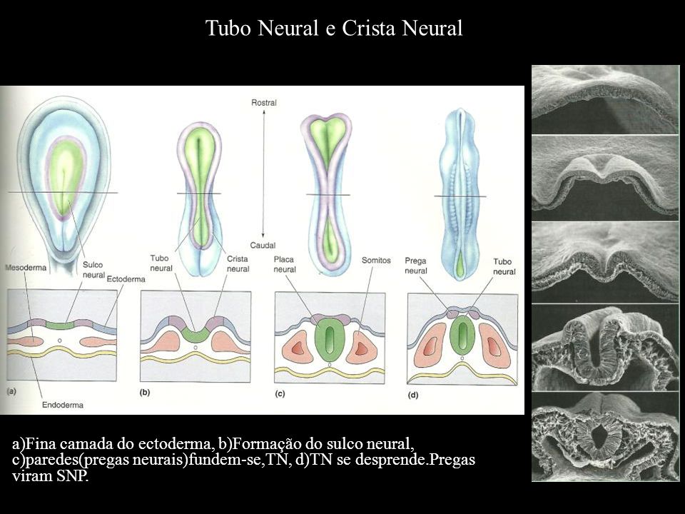 Tubo Neural e Crista Neural