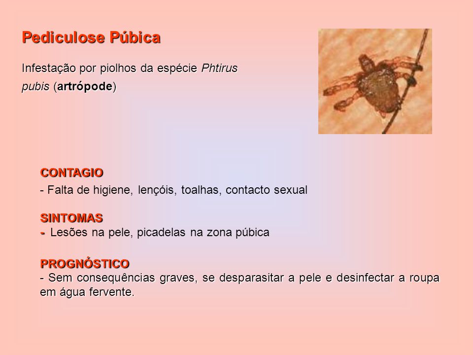 Pediculose Púbica Infestação por piolhos da espécie Phtirus pubis (artrópode) CONTAGIO. - Falta de higiene, lençóis, toalhas, contacto sexual.