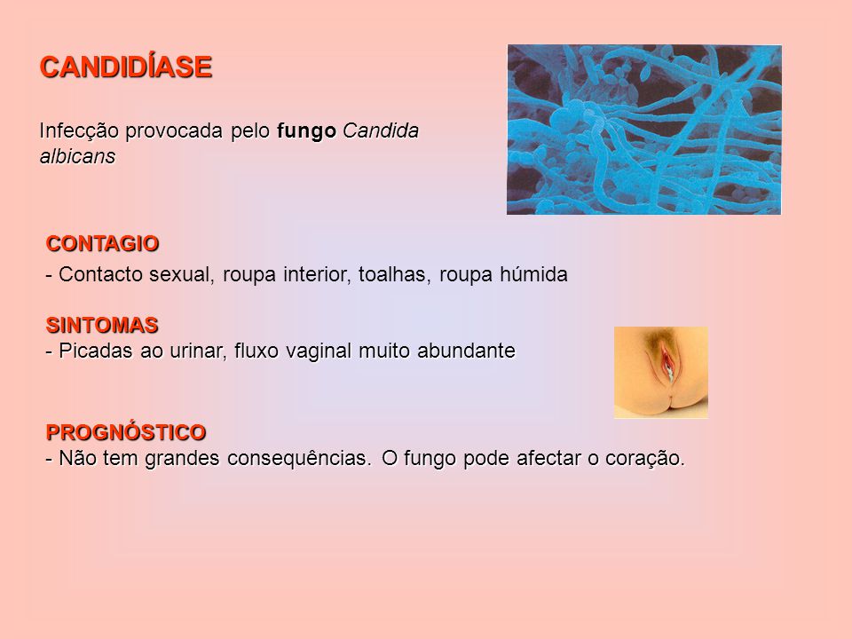 CANDIDÍASE Infecção provocada pelo fungo Candida albicans CONTAGIO