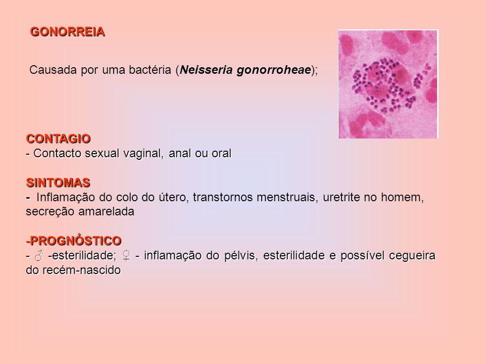 GONORREIA Causada por uma bactéria (Neisseria gonorroheae); CONTAGIO. Contacto sexual vaginal, anal ou oral.