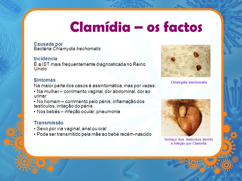 Clamídia – os factos Causada por Bactéria Chlamydia trachomatis