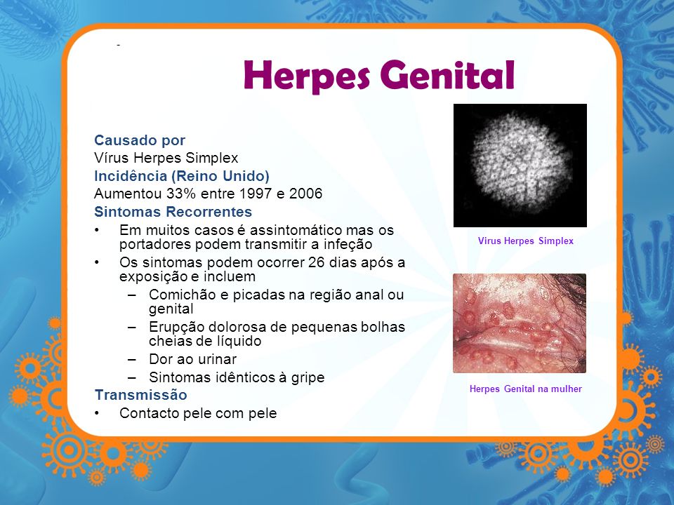 Herpes Genital na mulher