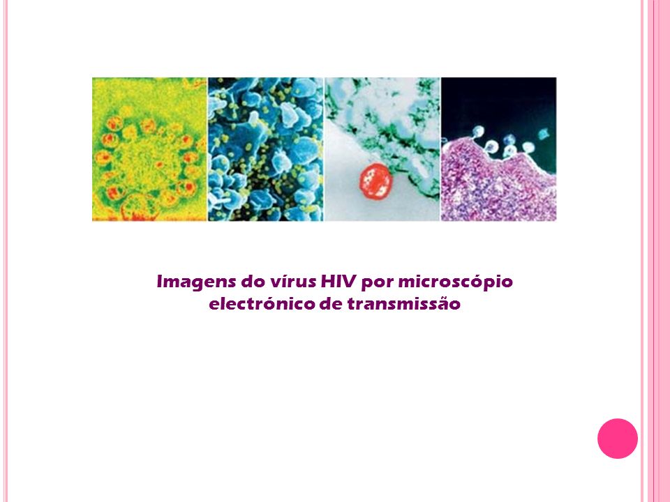 Imagens do vírus HIV por microscópio electrónico de transmissão