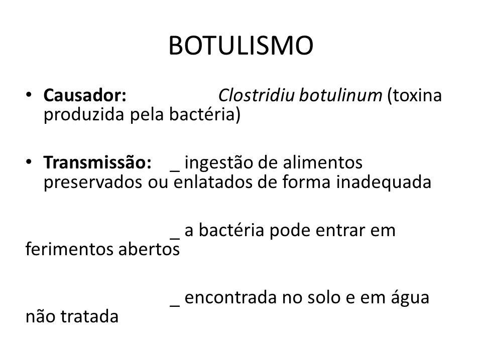 BOTULISMO Causador: Clostridiu botulinum (toxina produzida pela bactéria)