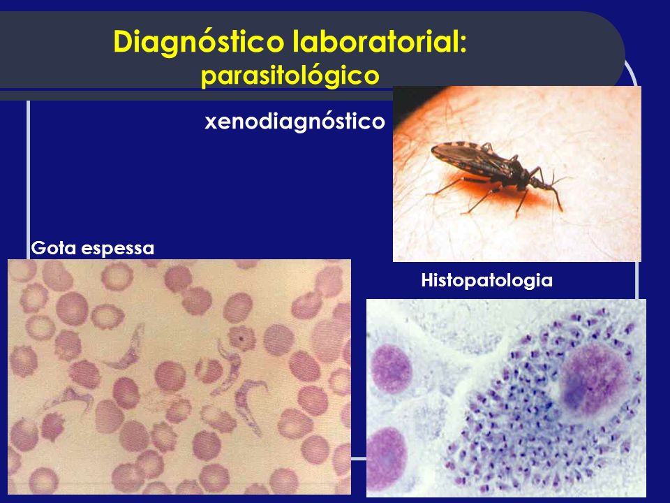 Diagnóstico laboratorial: parasitológico