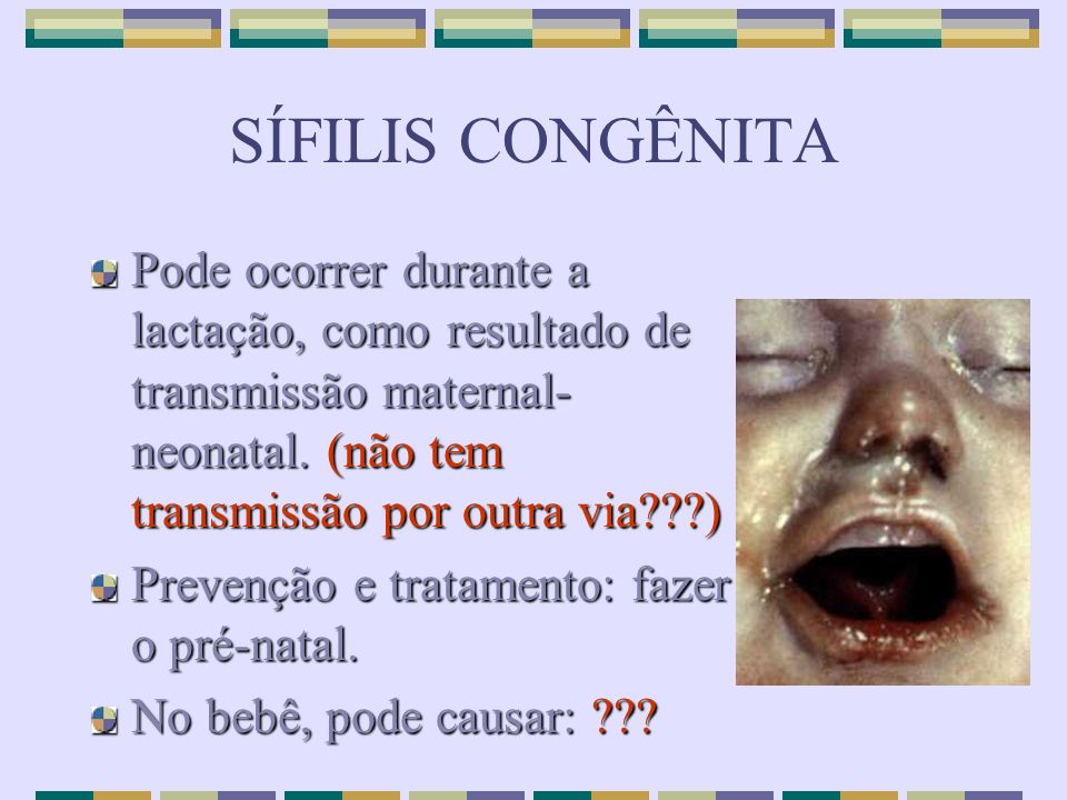 SÍFILIS CONGÊNITA Pode ocorrer durante a lactação, como resultado de transmissão maternal-neonatal. (não tem transmissão por outra via )