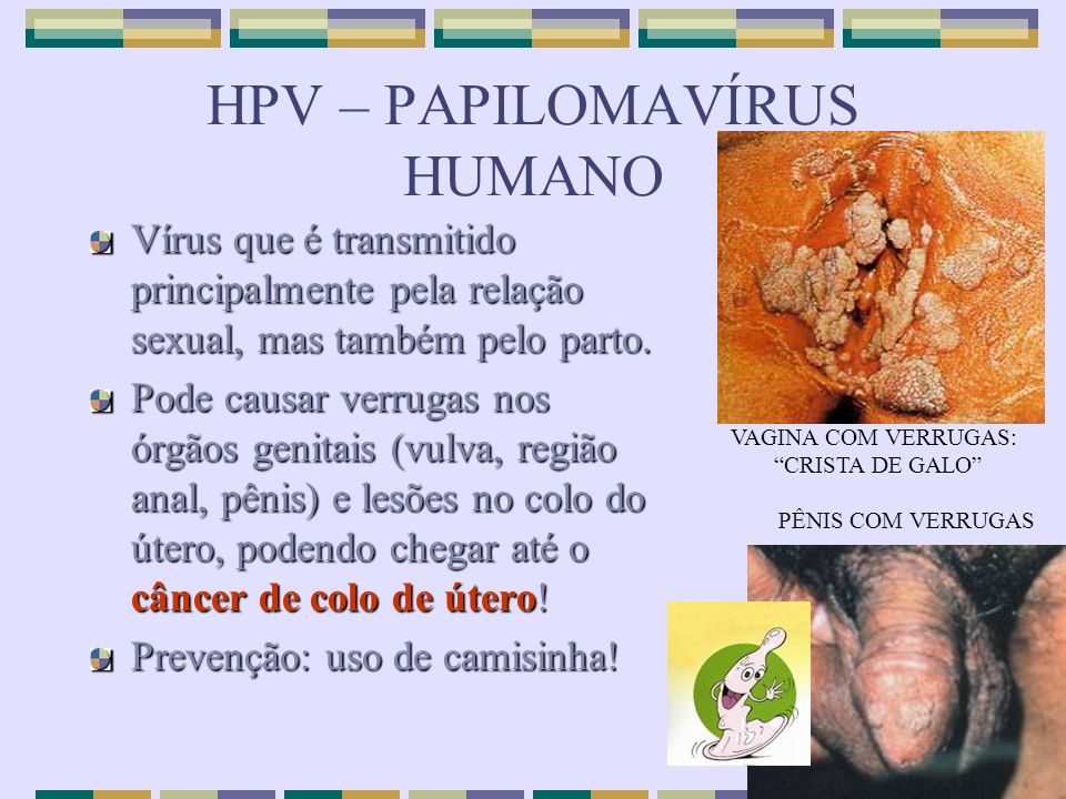 HPV – PAPILOMAVÍRUS HUMANO