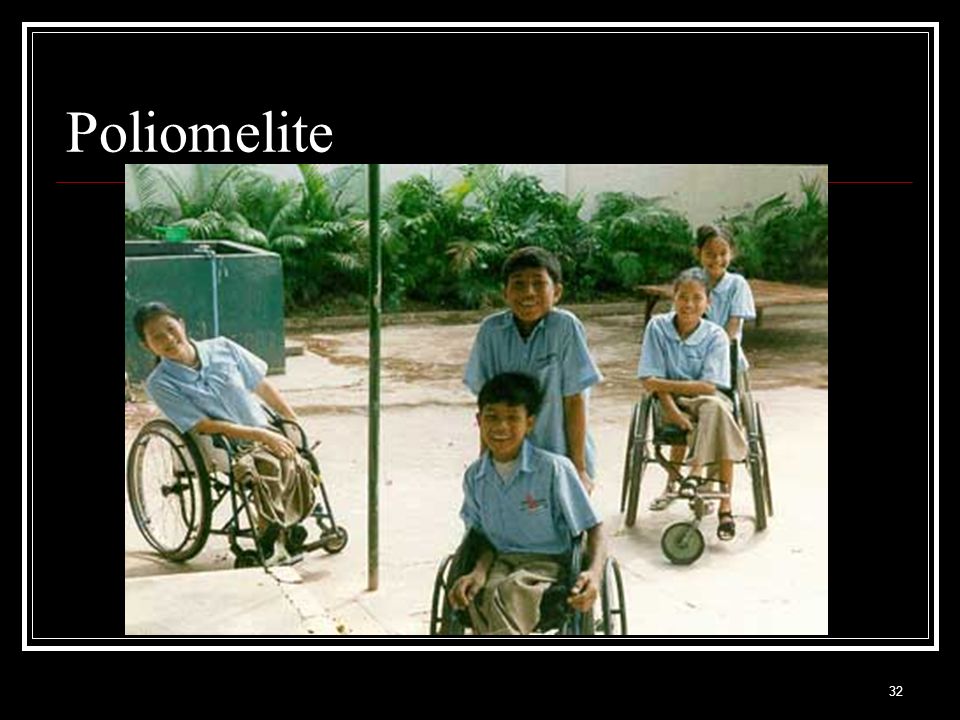 Poliomelite