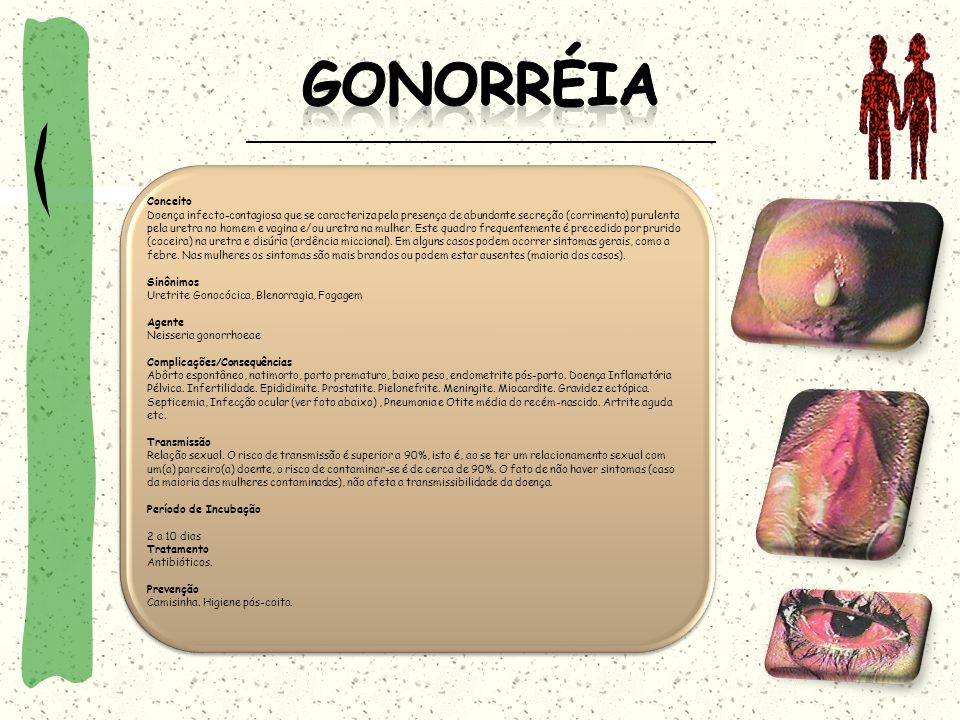 Gonorréia