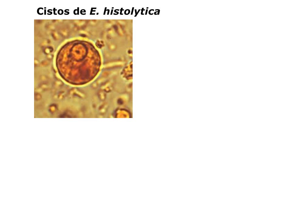 Cistos de E. histolytica