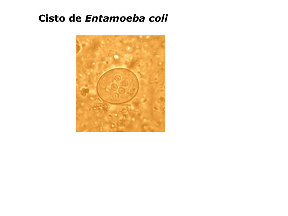 Cisto de Entamoeba coli