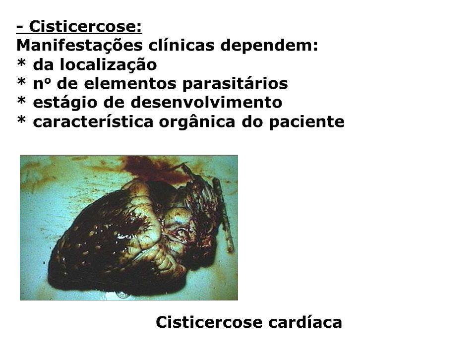 - Cisticercose: Manifestações clínicas dependem: * da localização. * no de elementos parasitários.