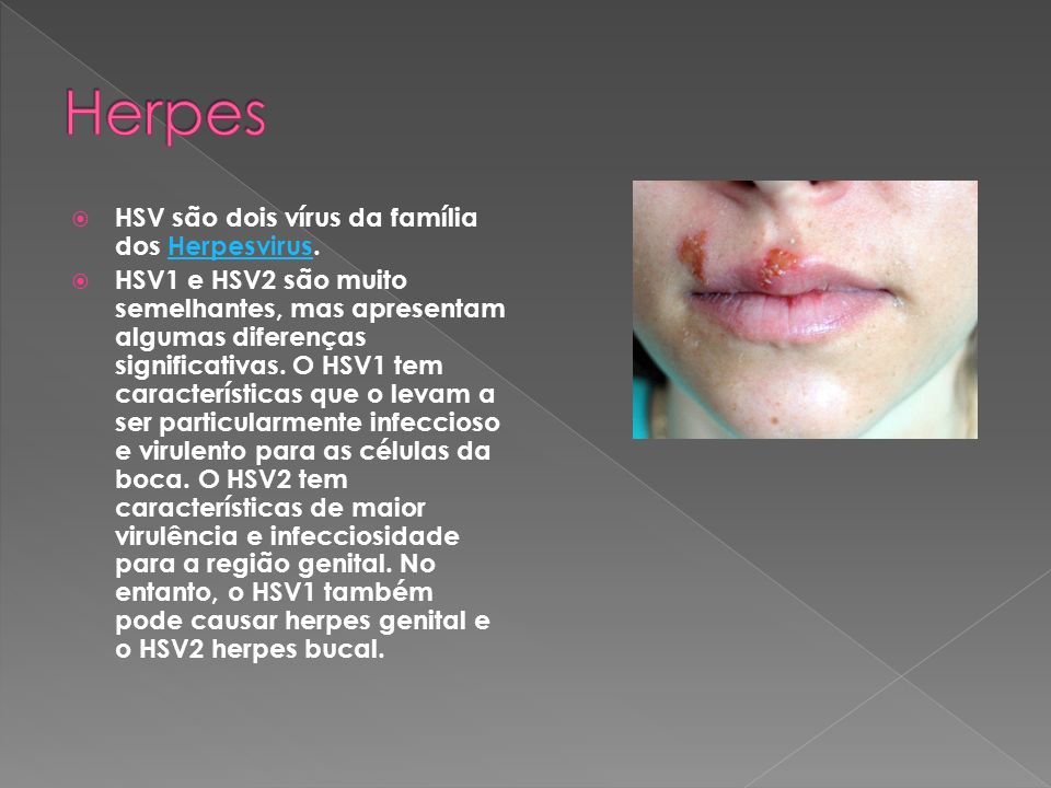Herpes HSV são dois vírus da família dos Herpesvirus.