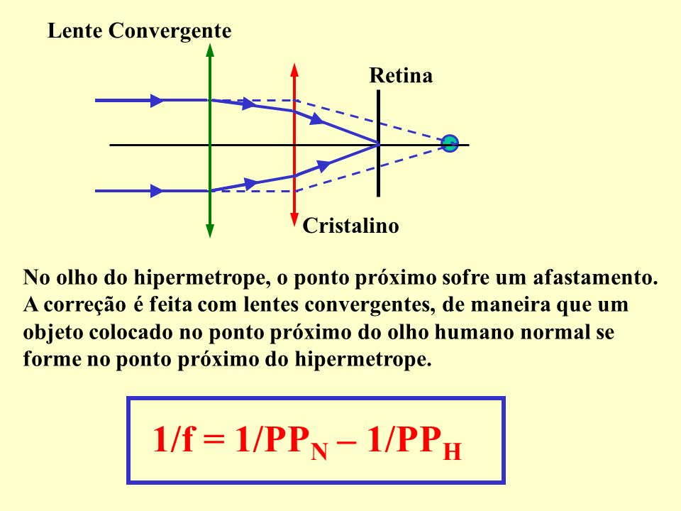 1/f = 1/PPN – 1/PPH Lente Convergente Retina Cristalino