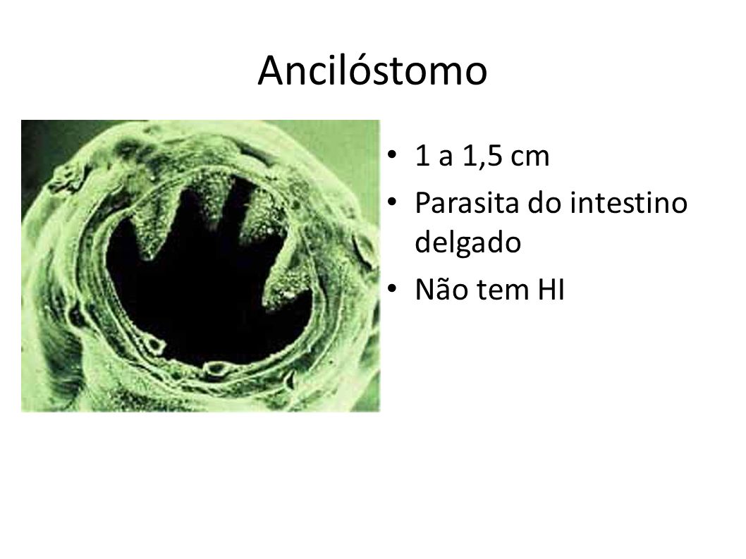 Ancilóstomo 1 a 1,5 cm Parasita do intestino delgado Não tem HI