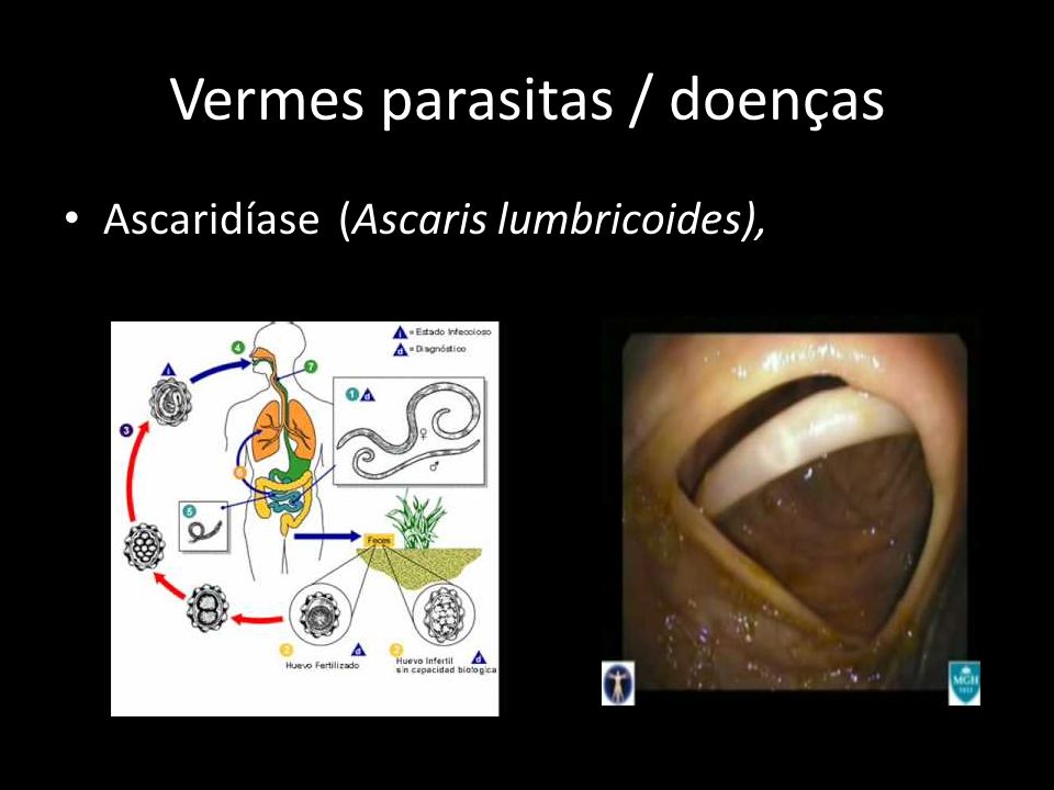 Vermes parasitas / doenças