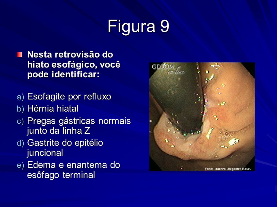 Figura 9 Nesta retrovisão do hiato esofágico, você pode identificar: