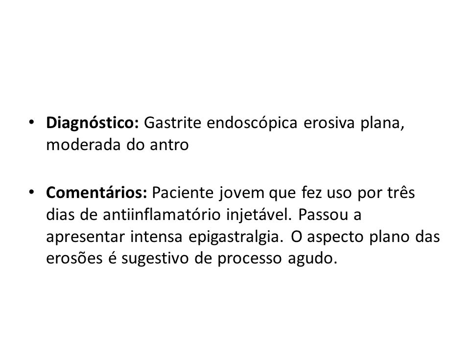 Diagnóstico: Gastrite endoscópica erosiva plana, moderada do antro