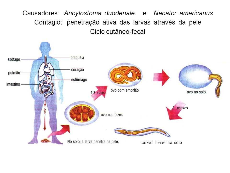 Causadores: Ancylostoma duodenale e Necator americanus