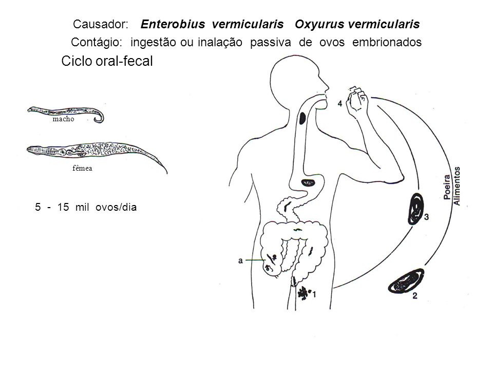 Causador: Enterobius vermicularis Oxyurus vermicularis