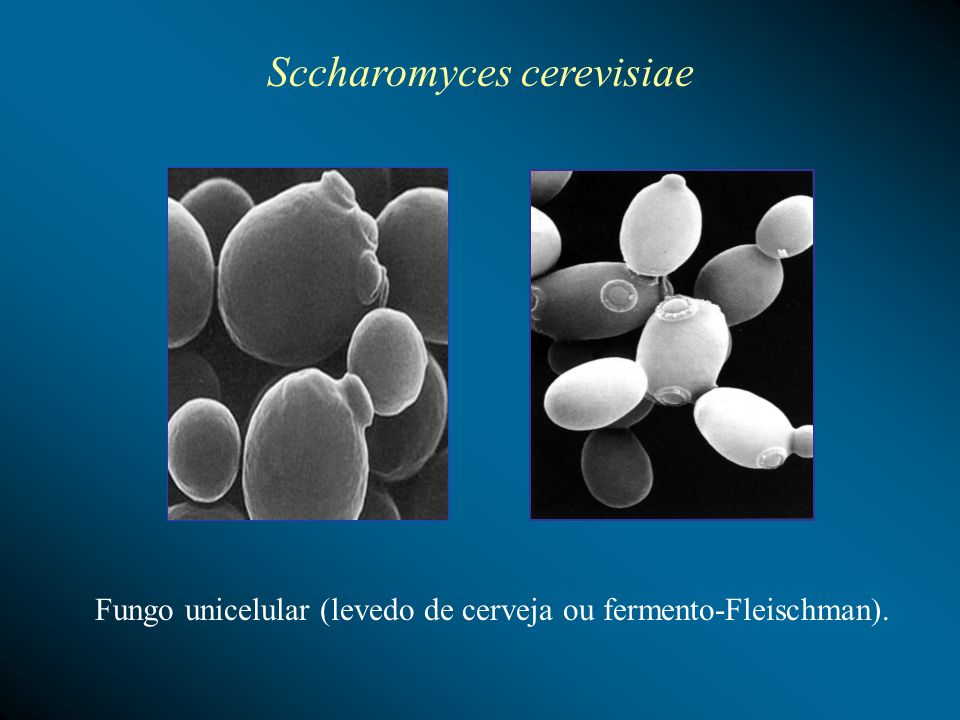 Sccharomyces cerevisiae