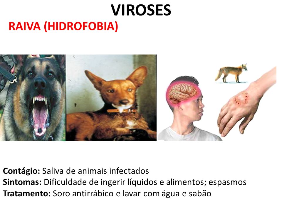 VIROSES RAIVA (HIDROFOBIA) Contágio: Saliva de animais infectados