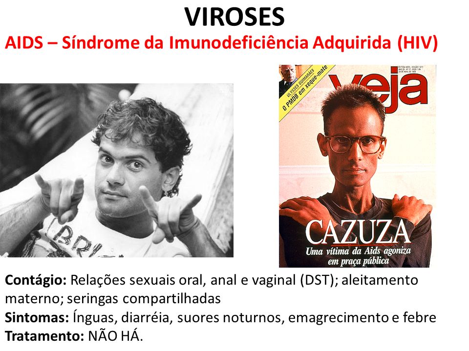 VIROSES AIDS – Síndrome da Imunodeficiência Adquirida (HIV)
