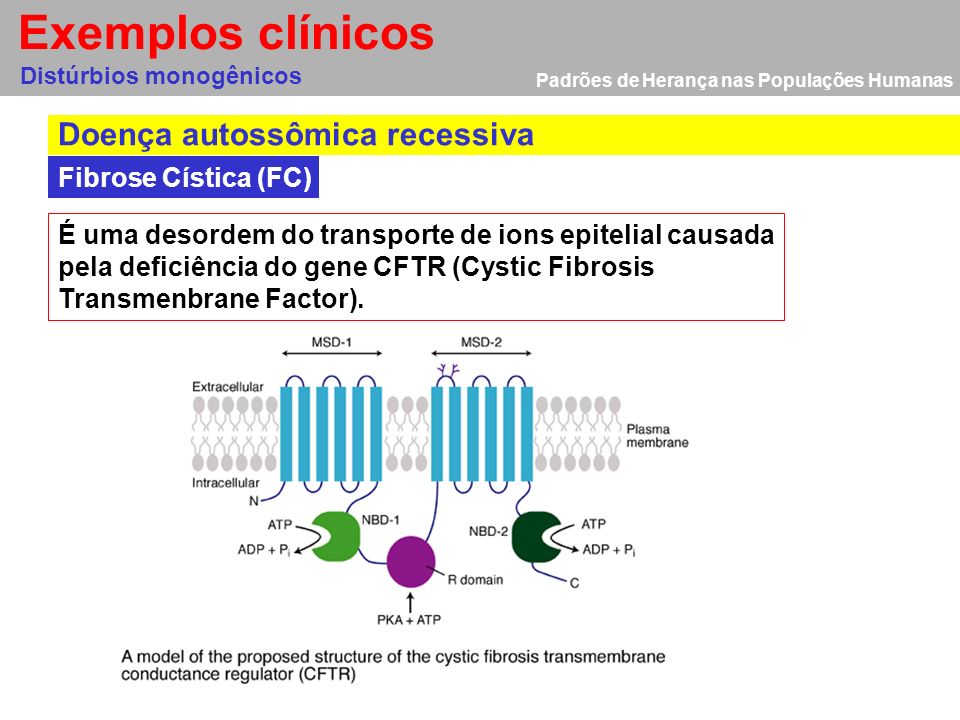Exemplos clínicos Doença autossômica recessiva Fibrose Cística (FC)