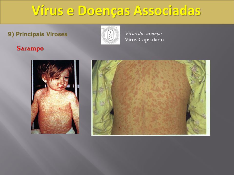 Vírus e Doenças Associadas
