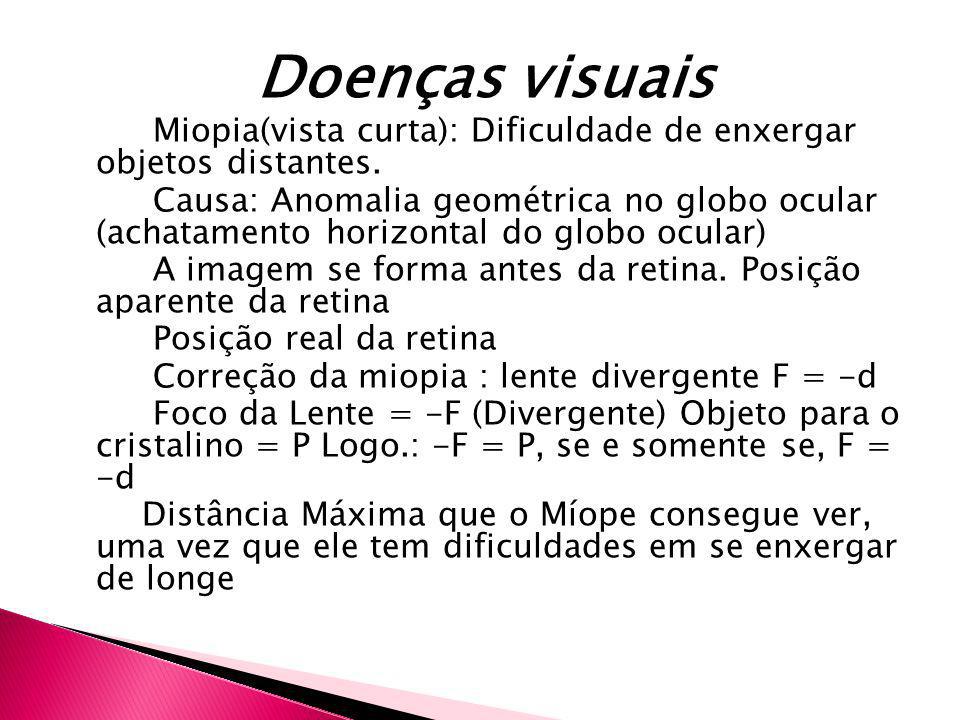 Doenças visuais Miopia(vista curta): Dificuldade de enxergar objetos distantes.