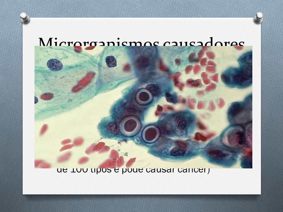 Microrganismos causadores