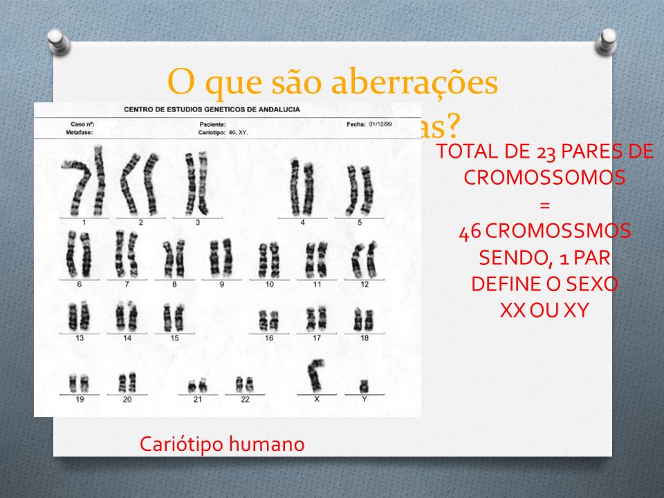 O que são aberrações cromossômicas