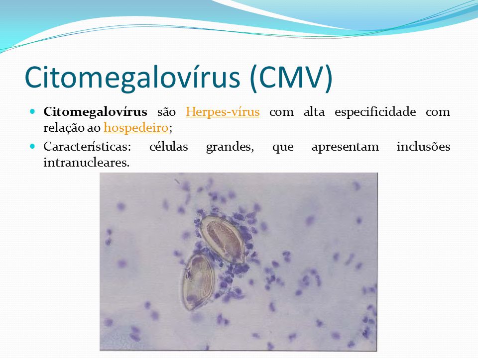 Citomegalovírus (CMV)