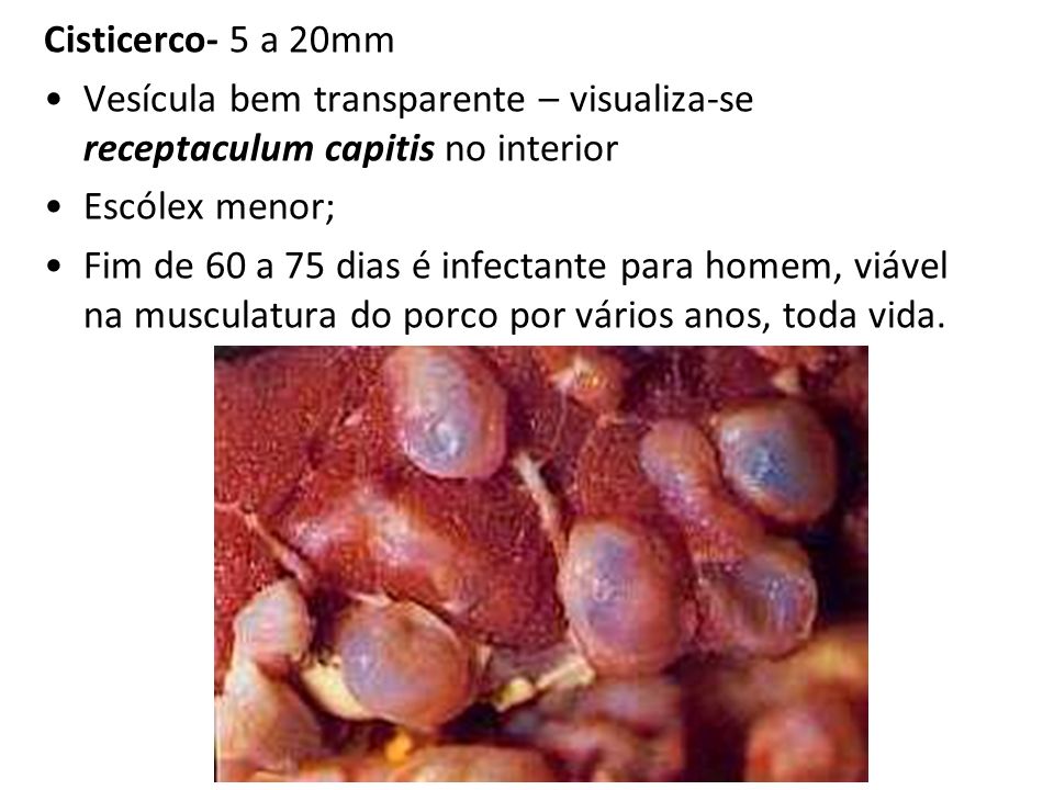 Cisticerco- 5 a 20mm Vesícula bem transparente – visualiza-se receptaculum capitis no interior. Escólex menor;