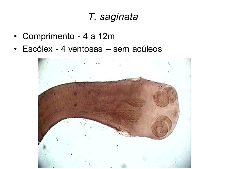 T. saginata Comprimento - 4 a 12m Escólex - 4 ventosas – sem acúleos