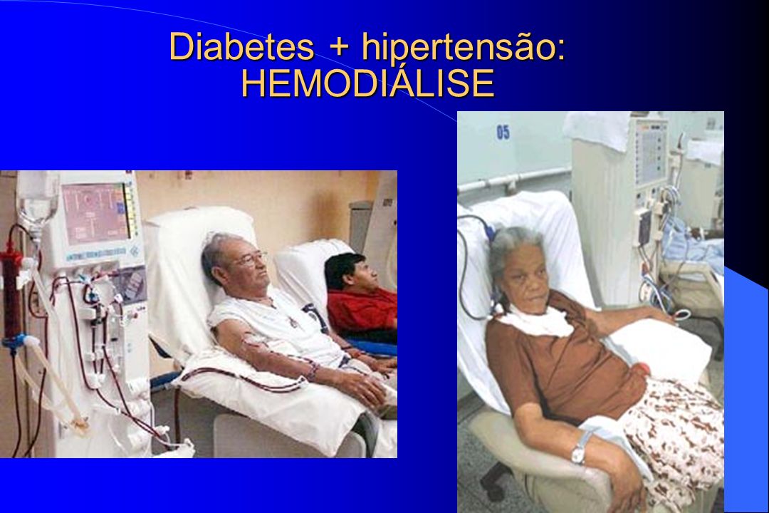 Diabetes + hipertensão: HEMODIÁLISE