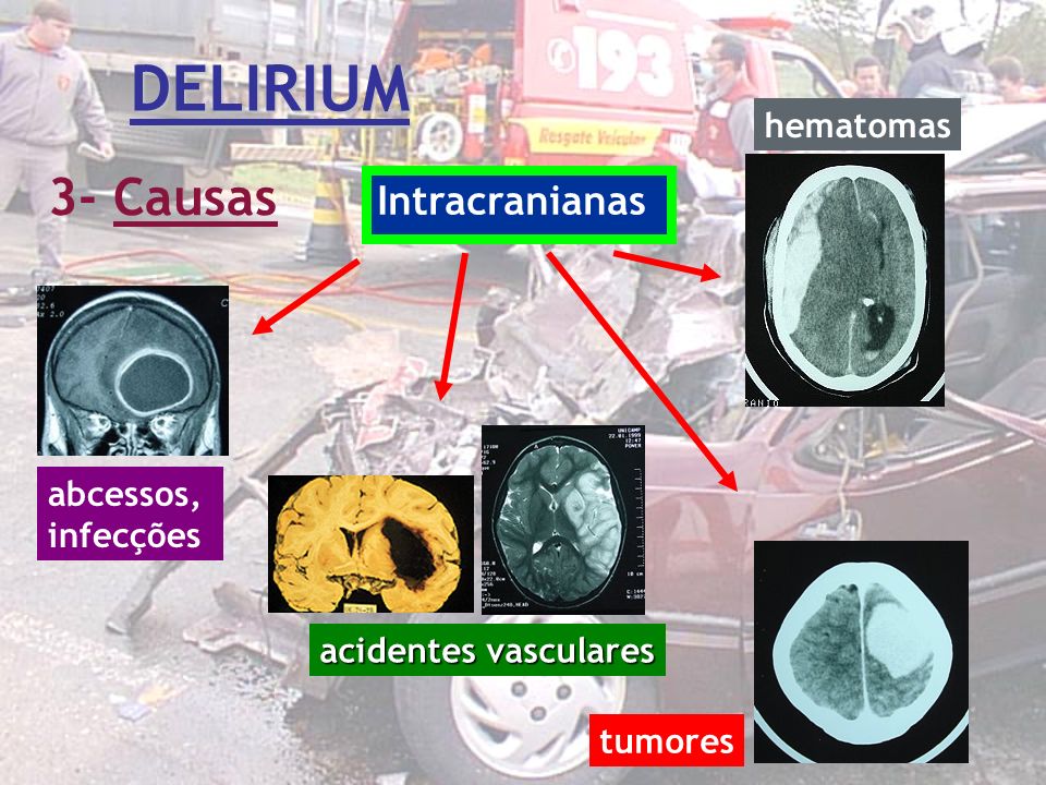 DELIRIUM 3- Causas Intracranianas hematomas abcessos, infecções