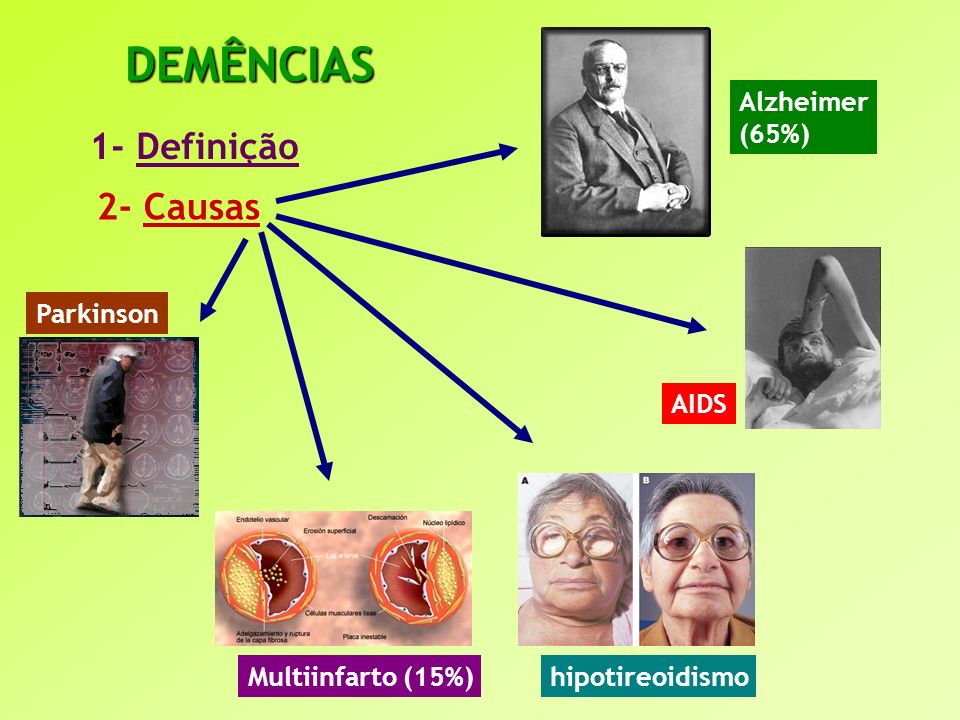 DEMÊNCIAS 1- Definição 2- Causas Alzheimer (65%) Parkinson AIDS
