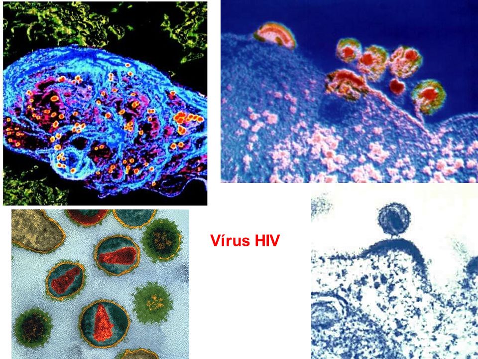 Vírus HIV