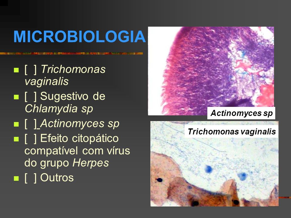 MICROBIOLOGIA [ ] Trichomonas vaginalis [ ] Sugestivo de Chlamydia sp