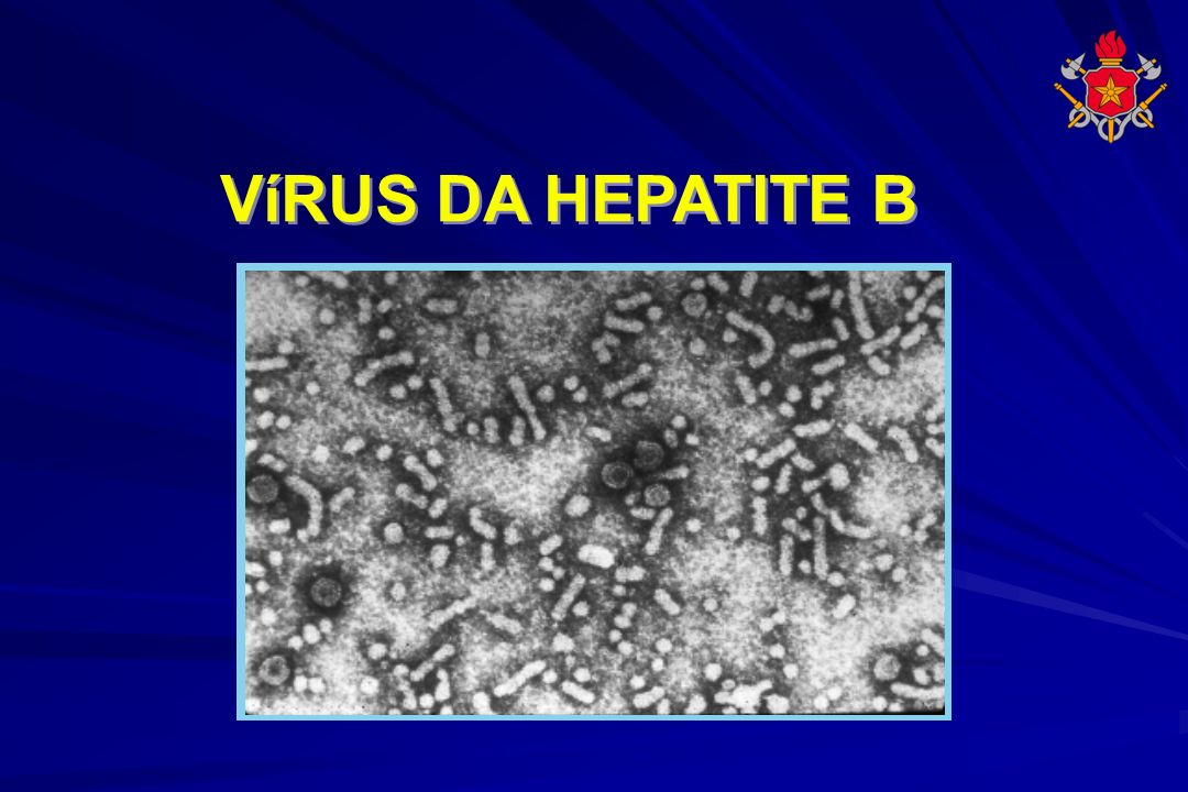 VíRUS DA HEPATITE B 28