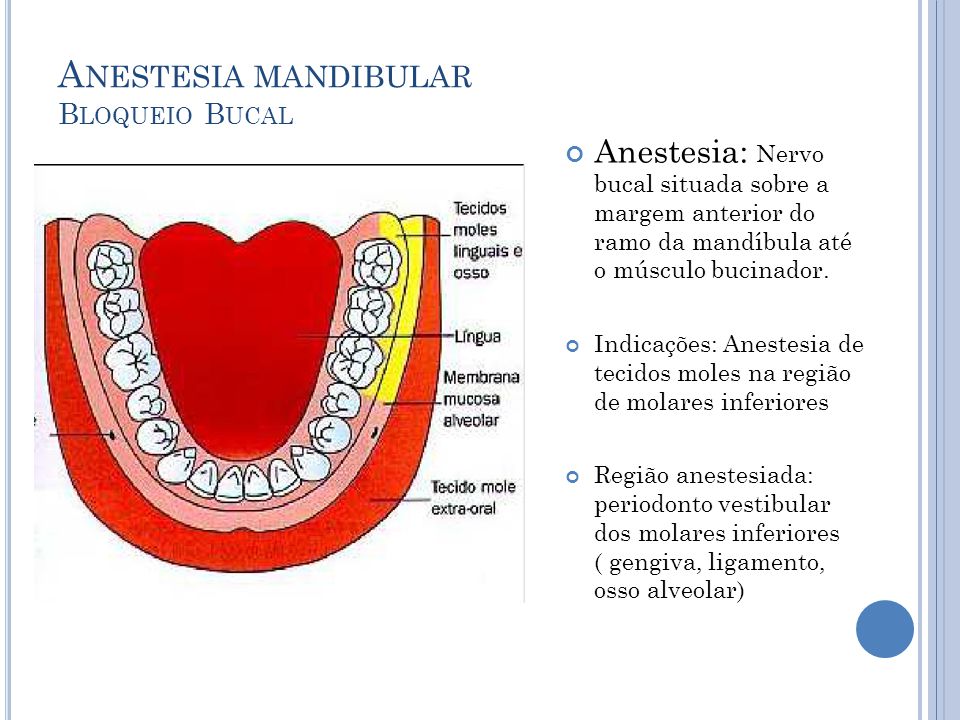 Anestesia mandibular Bloqueio Bucal