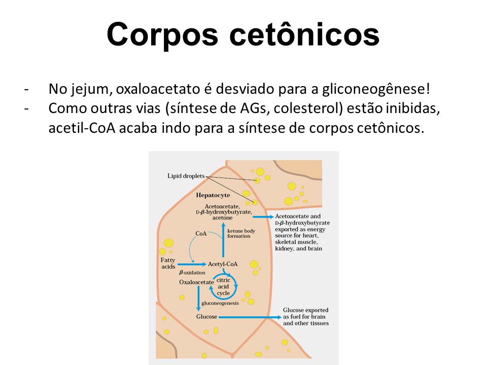 Corpos cetônicos No jejum, oxaloacetato é desviado para a gliconeogênese!
