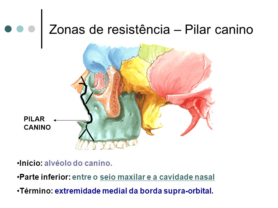 Zonas de resistência – Pilar canino