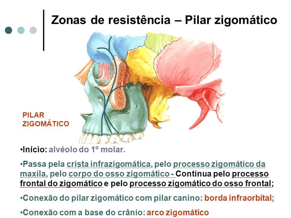 Zonas de resistência – Pilar zigomático